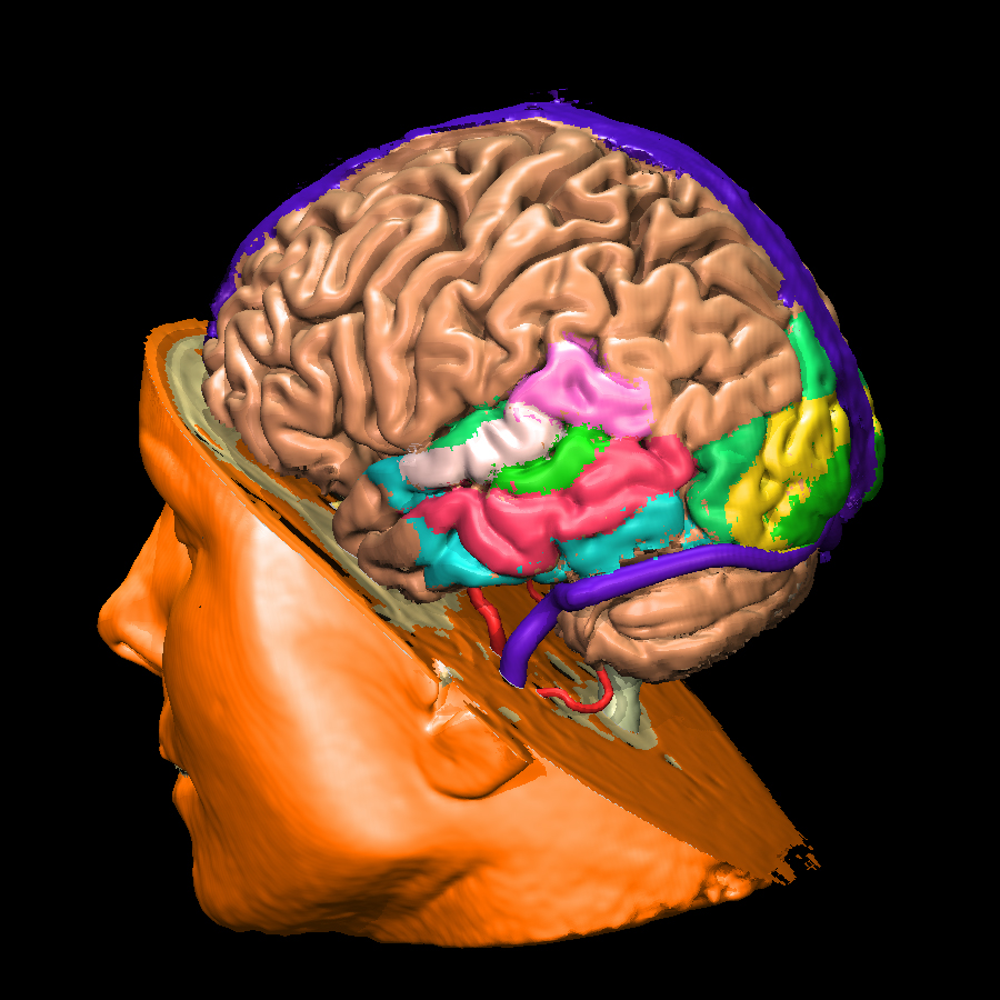 Voxel-man-brain.jpg